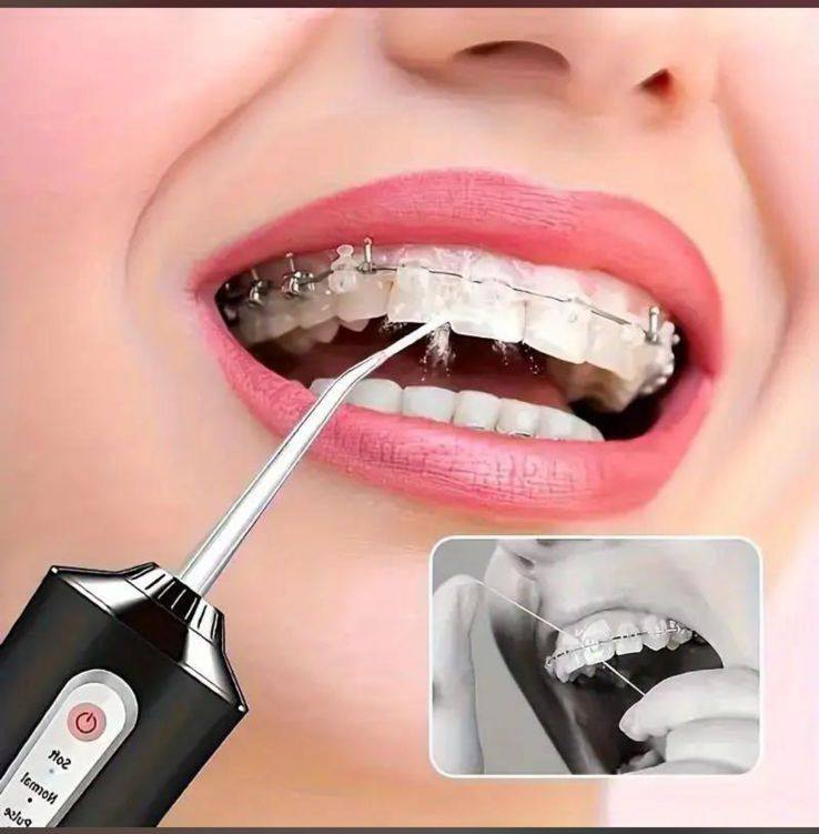 IRRIGADOR DENTAL + CEPILLO ULTRASÓNICO